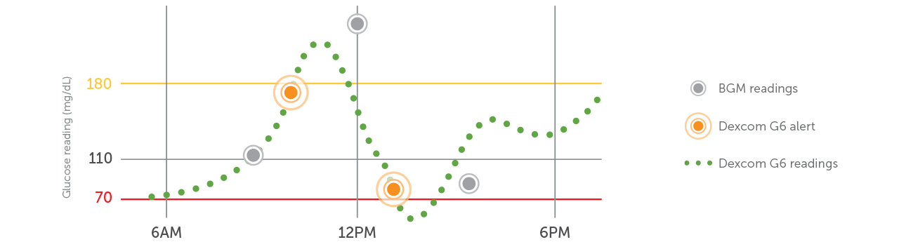 CGM vs BGM Chart