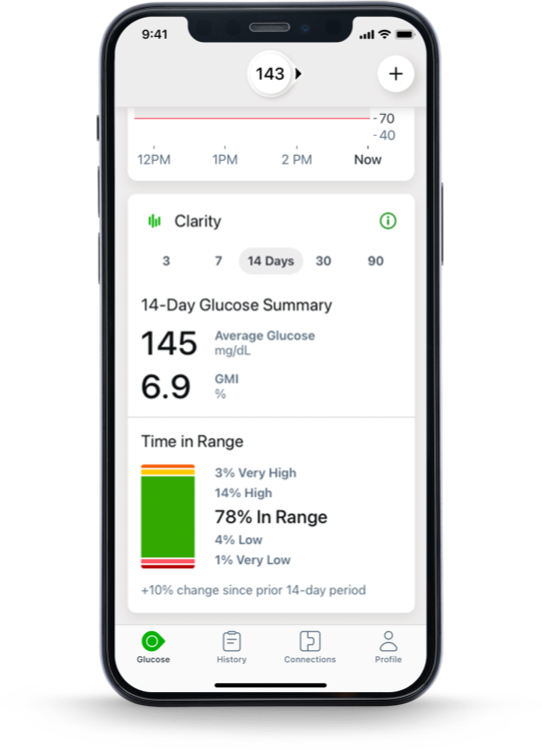 Dexcom G7 Mobile Application for Glucose Management