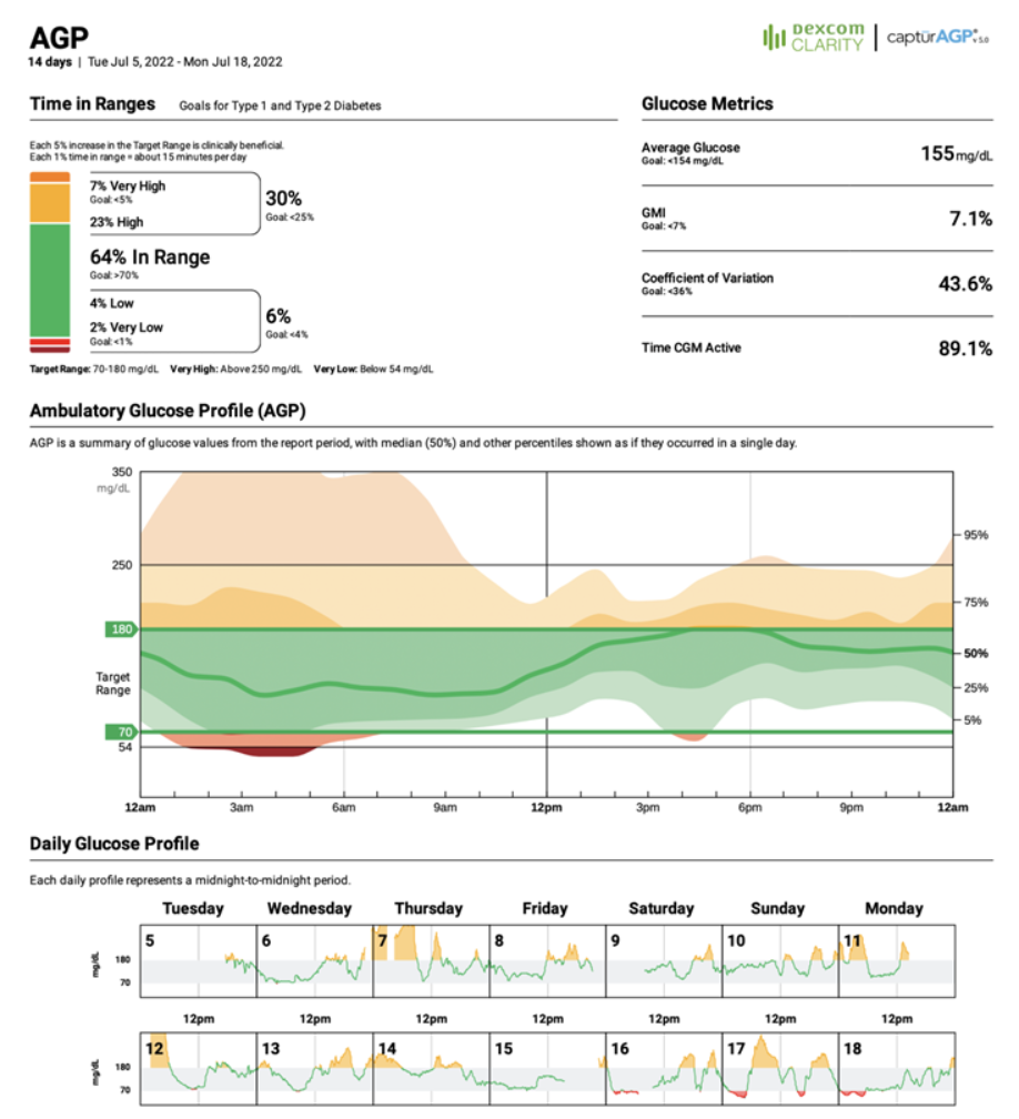 dexcom clarity agp report